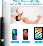 Earwax Remover Tool with Camera